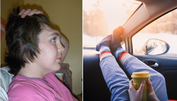 mat ca tran 0