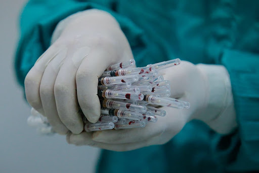 vaccine dau hang
