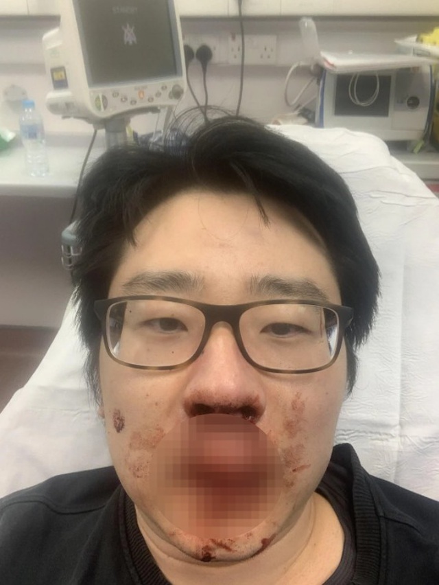 anh 1614756540188