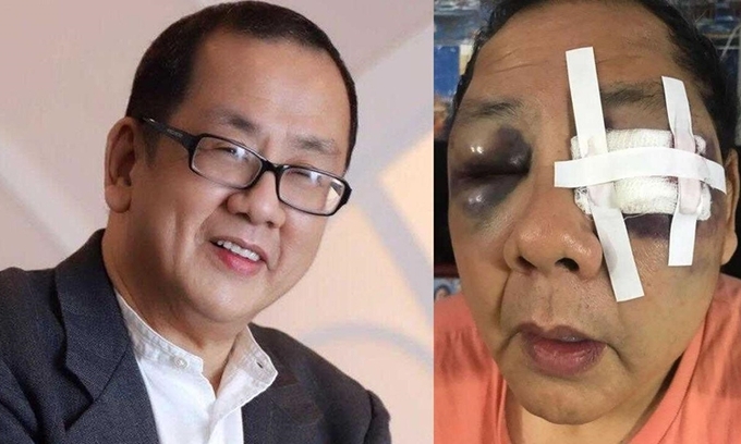 bi danh bat tinh