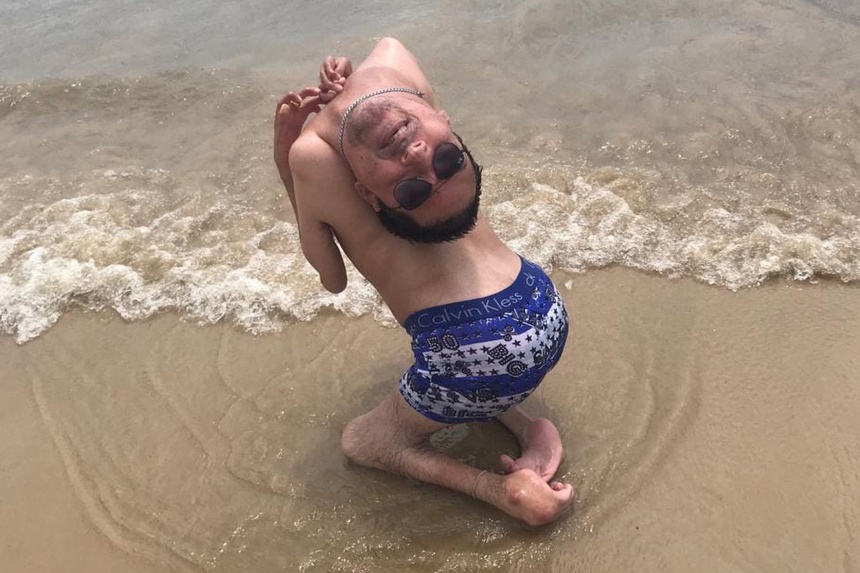 brazil upsidedown head 1