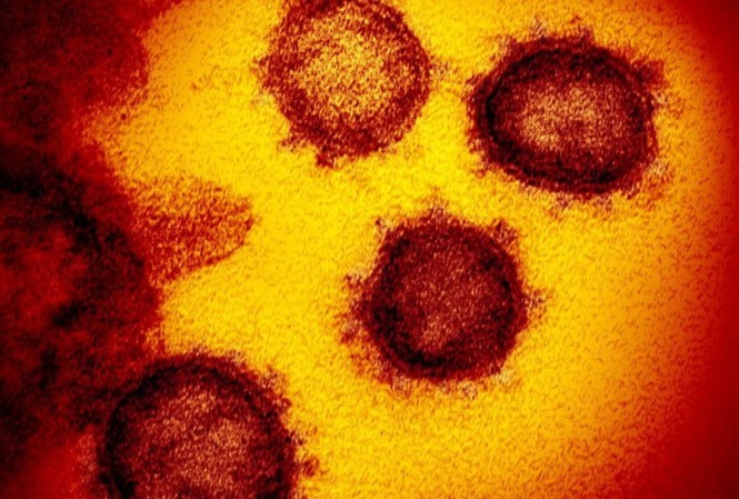 virus xwhb