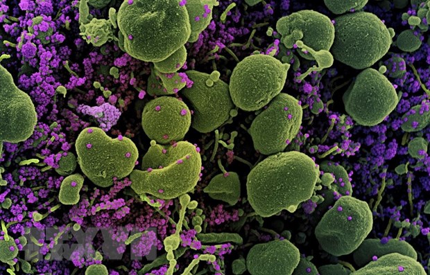 ttxvnbienthemoivirus0301