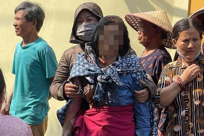 me bi bong nang 1