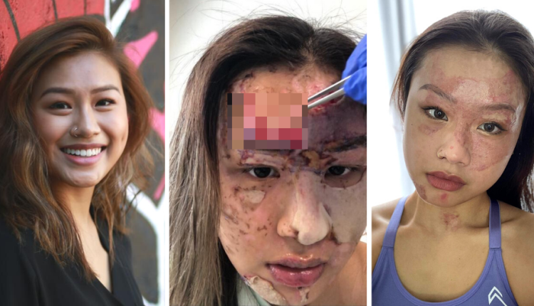 Charlene Chew bong nang 1