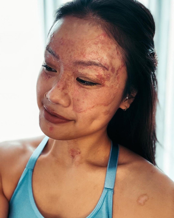 Charlene Chew bong nang 1