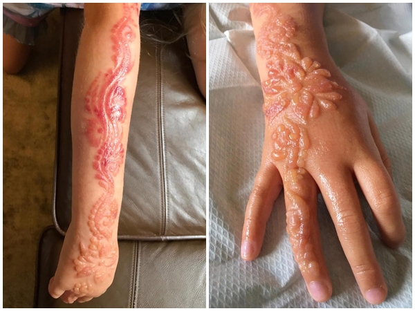 xam henna 1