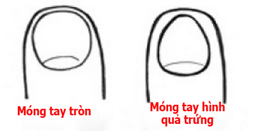 doan tinh cach qua hinh dang mong tay 1