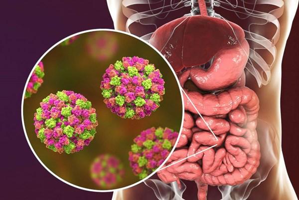 norovirus viem da day
