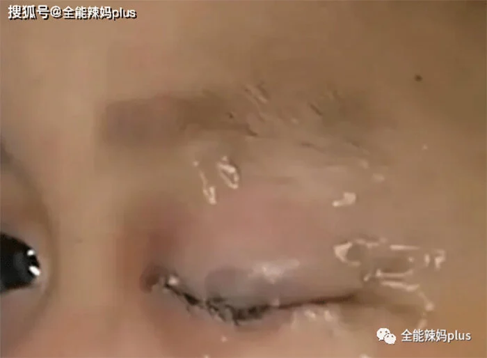 nuoc mat dinh bang keo 1