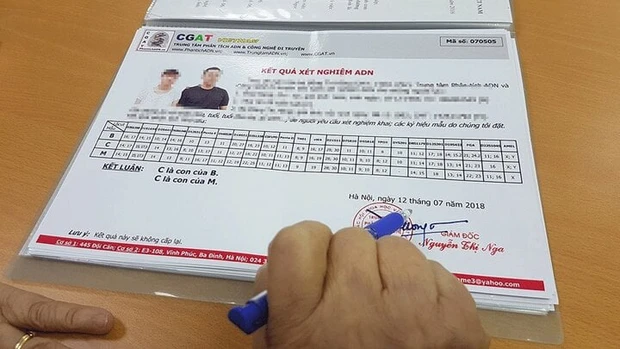 xet nghiem huyet thong