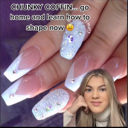 mau mong nail xau 9