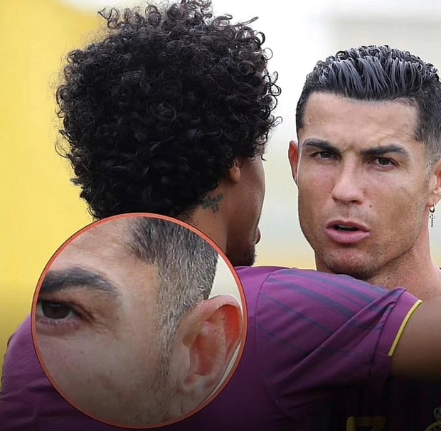 ronaldo toc bac 1