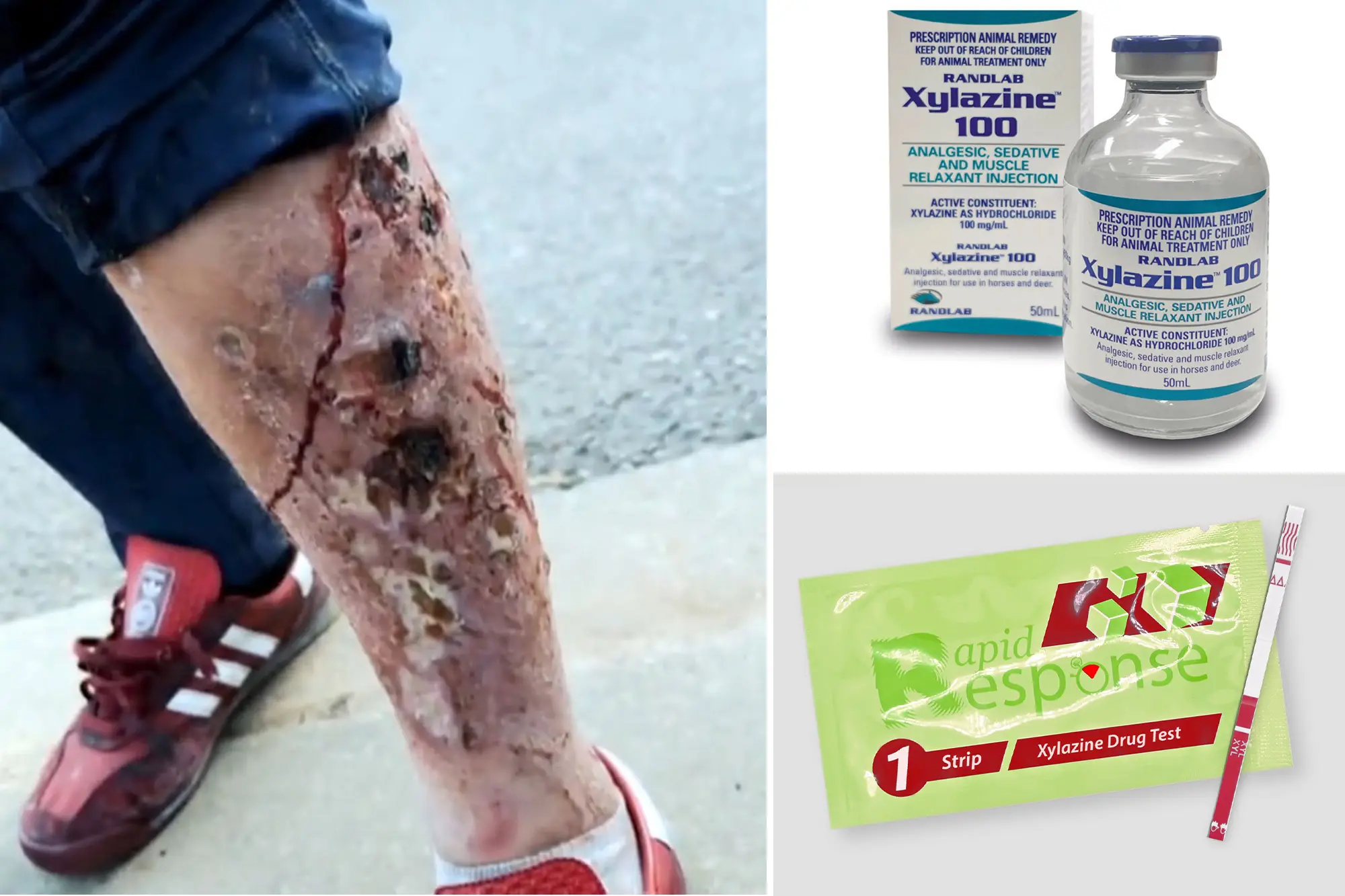 xylazine