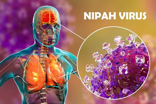 virus nipah 1