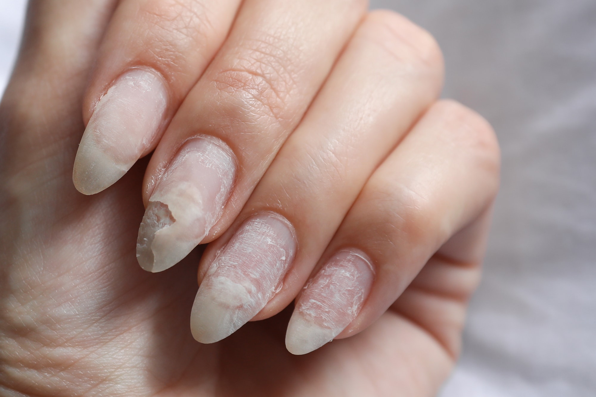MMA nail