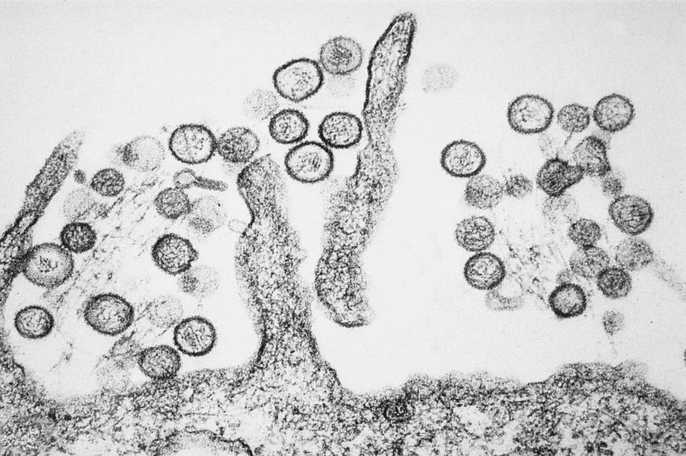 ong chua virus