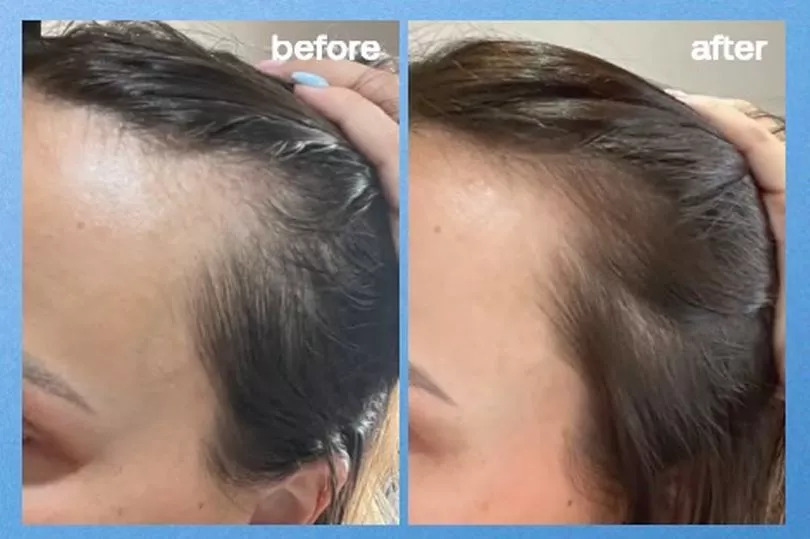 UKLash Hair Growth Serum 1