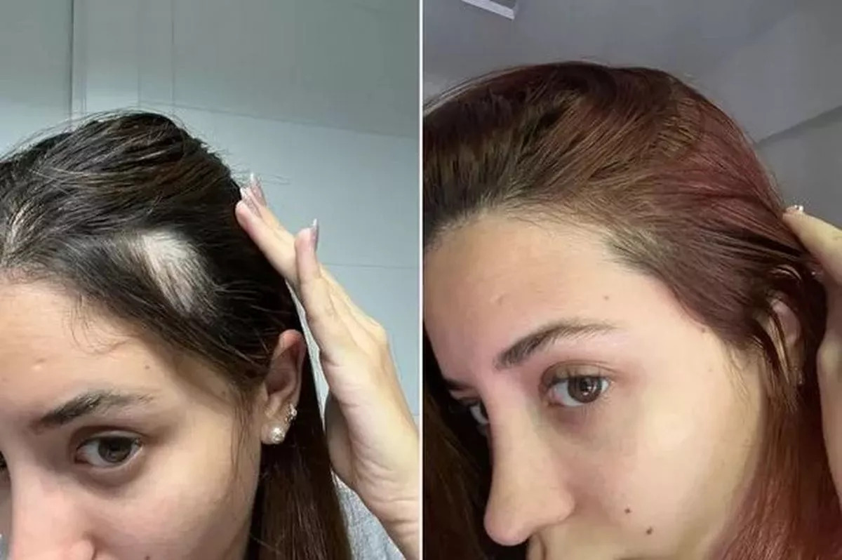 UKLash Hair Growth Serum 1