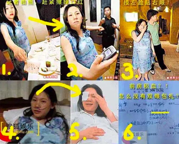 trieu vy 1