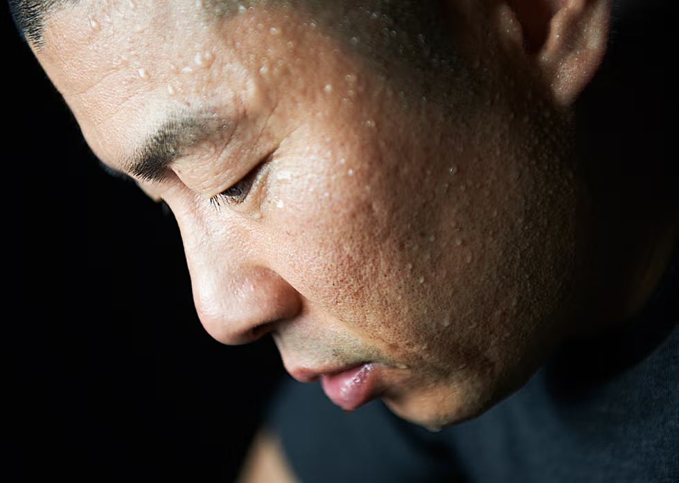 dau hieu dot quy