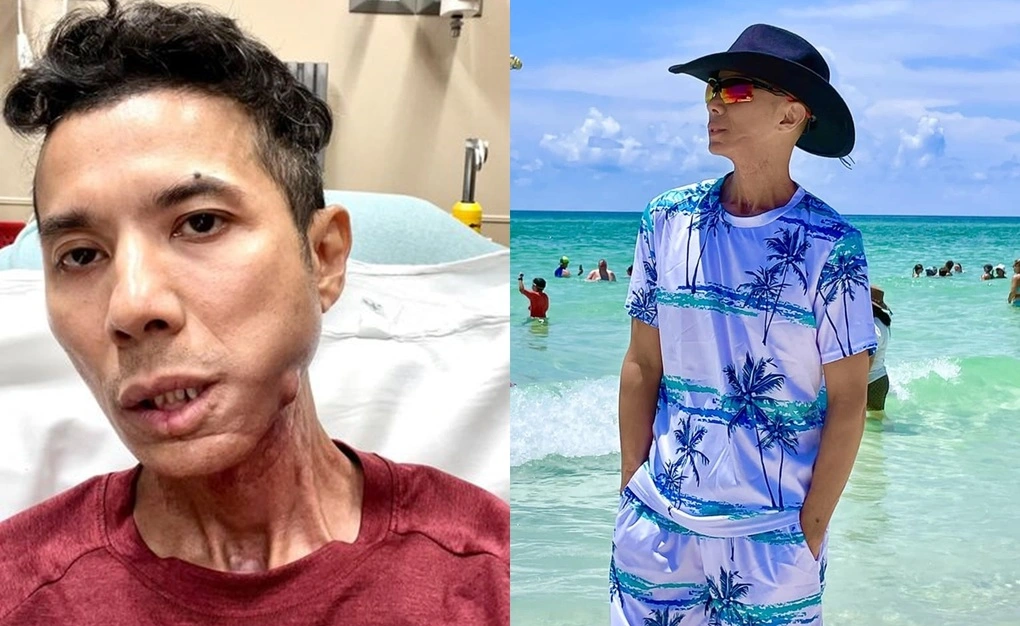 kasim hoang vu 1