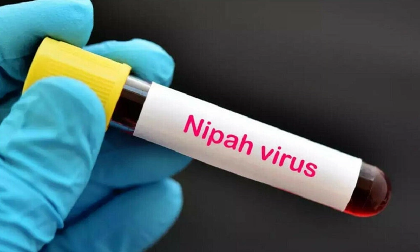 nipah virus