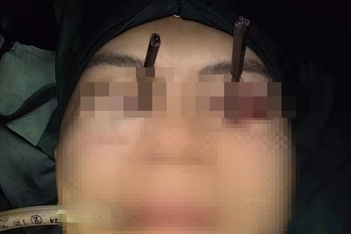 2 chiec dua 1