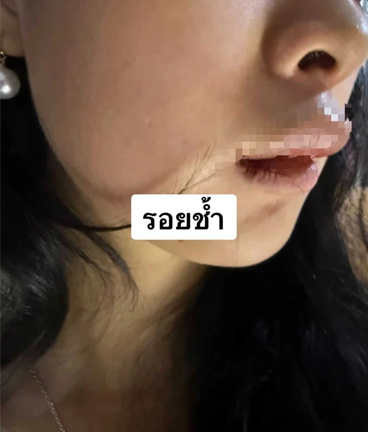 bat coc o thai lan 1