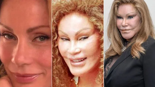 Jocelyn Wildenstein 1
