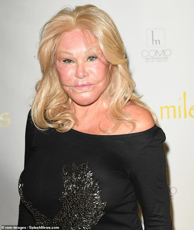 Jocelyn Wildenstein 1