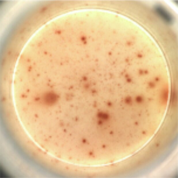 vaccine hiv 2