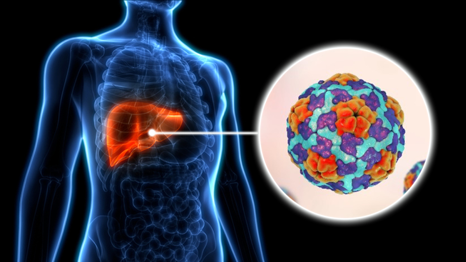 what is hepatitis a thumbnail 9032 8856 1749721924